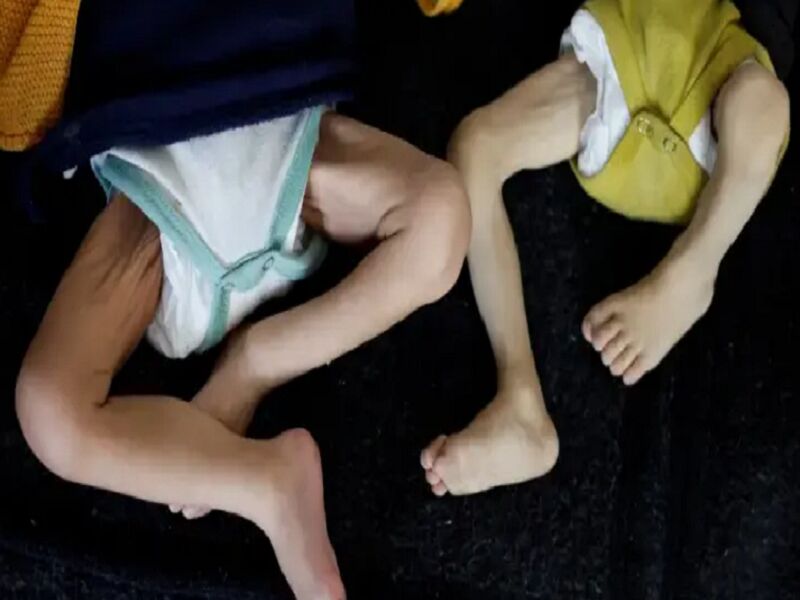 مسئول بیمارستان ناصر در غزه: جان هزاران کودک این باریکه در خطر است
